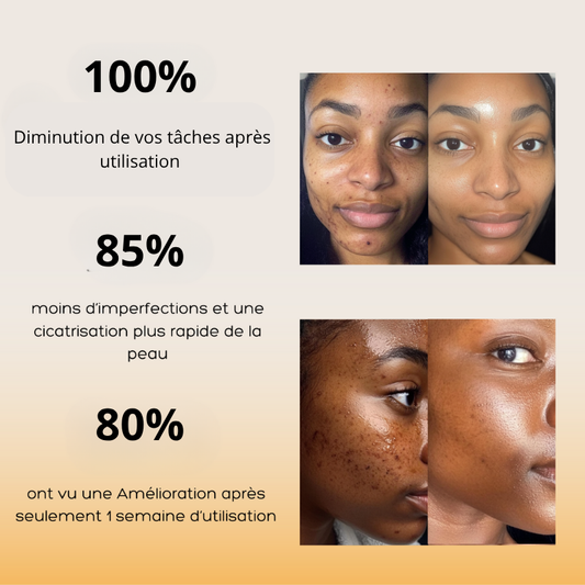 50 Pads Nettoyants au Curcuma 3 en 1 - Curcuskin care